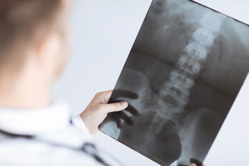 X-Rays Murfreesboro, TN